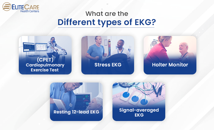 What Are the Different Types of EKG?
