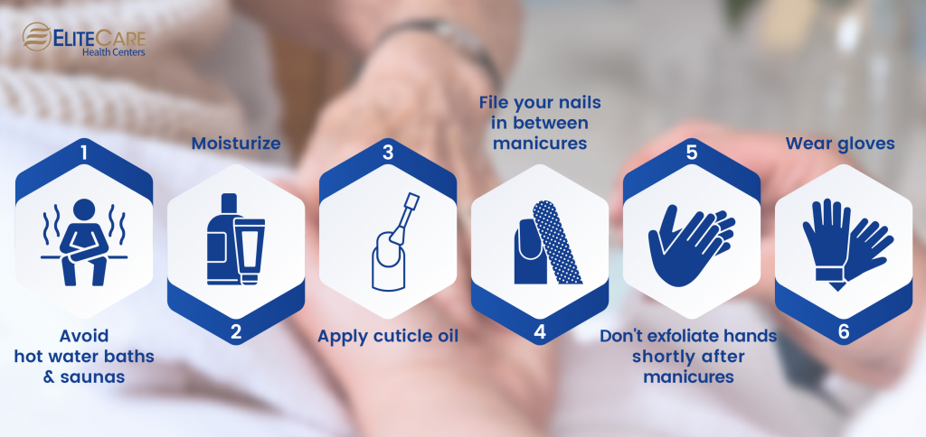 6 Manicure Aftercare Tips You Need to Know