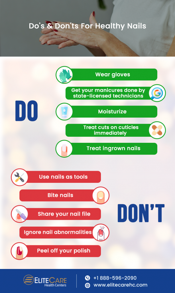 Do's & Don'ts For Healthy Nails | Infographic