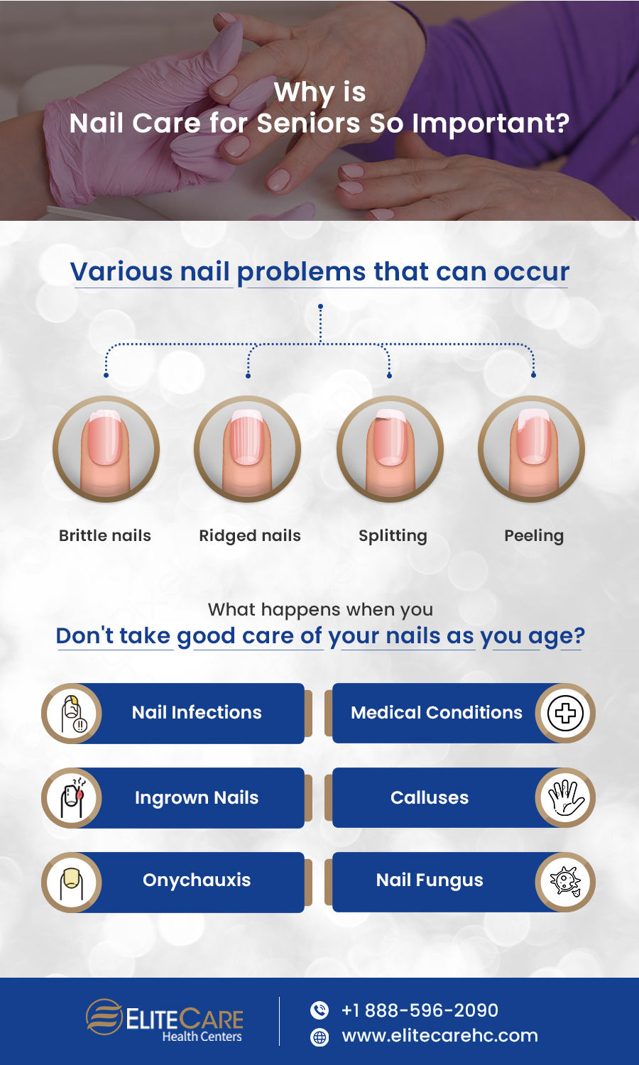Why is Nail Care for Seniors so Important? | Infographic