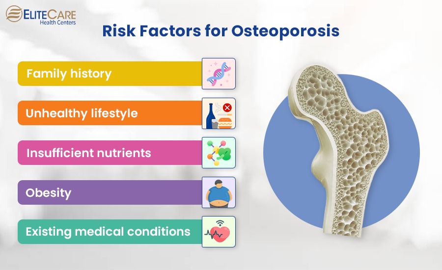 Risk Factors for Osteoporosis