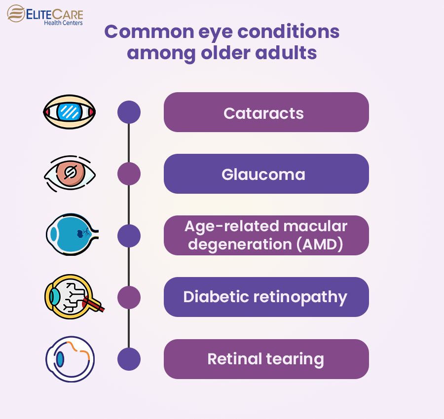 Common Eye Conditions Among Older Adults