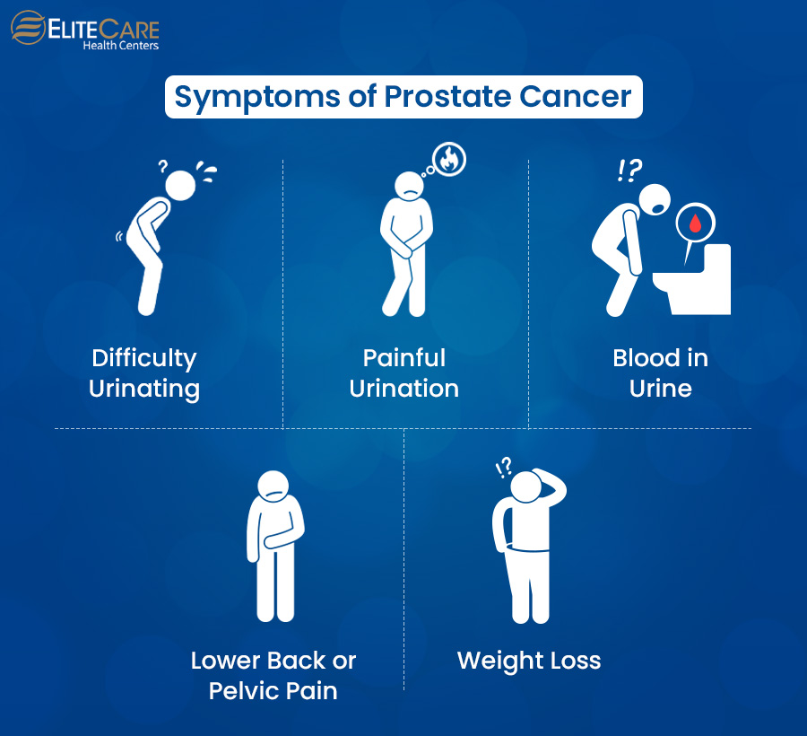 Symptoms of Prostate Cancer