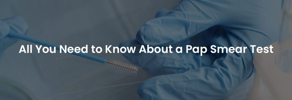 All You Need to Know About a Pap Smear Test | Banner Image