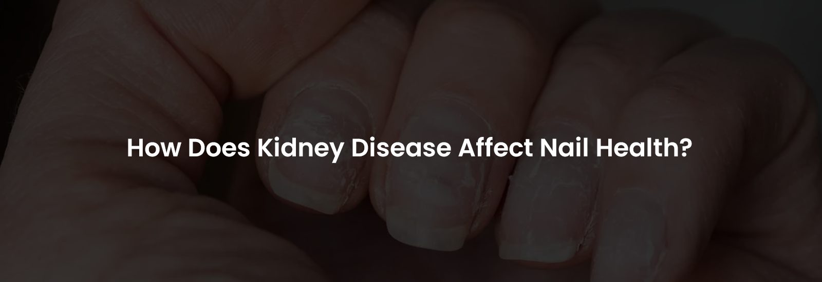 How Does Kidney Disease Affect Nail Health | Banner Image