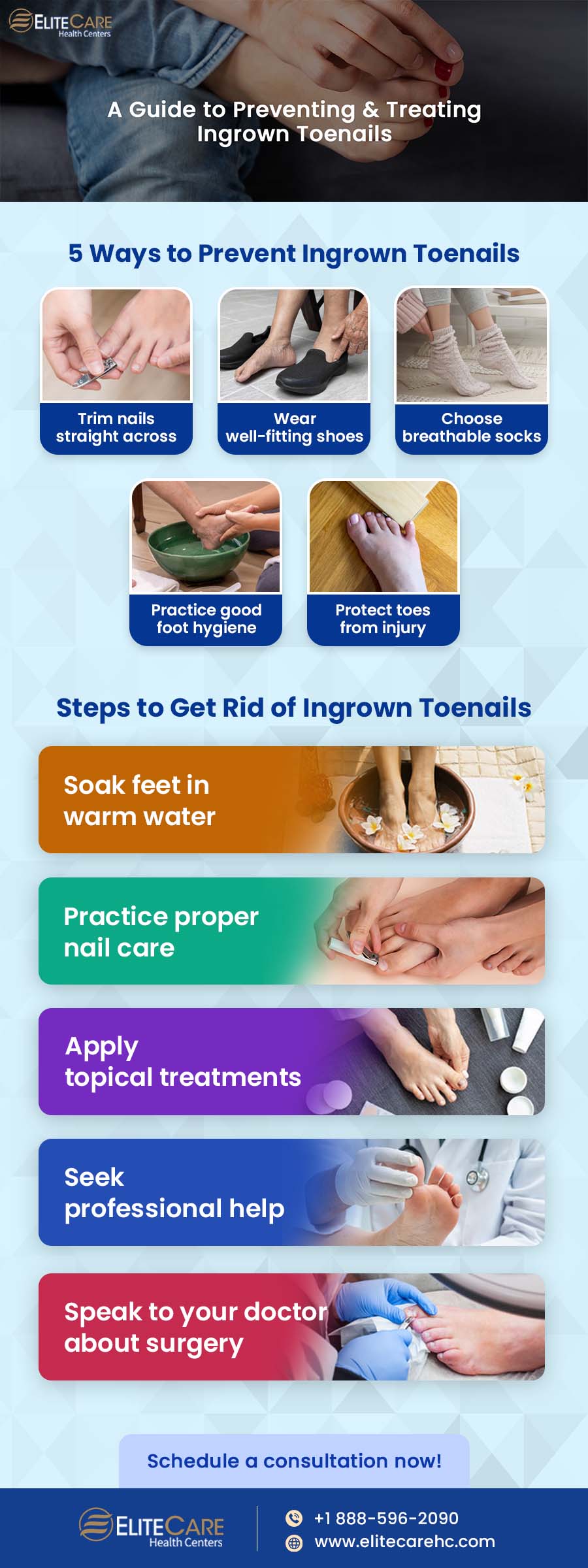 A Guide to Preventing & Treating Ingrown Toenails | Infographic