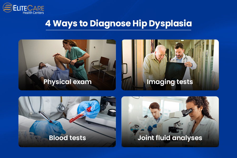 4 Ways to Diagnose Hip Dysplasia