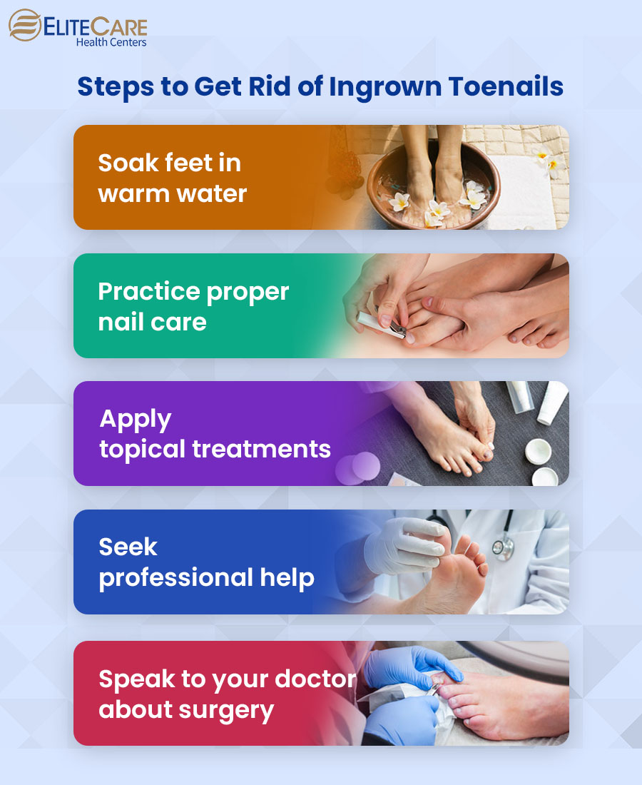 Steps to Get Rid of Ingrown Toenails