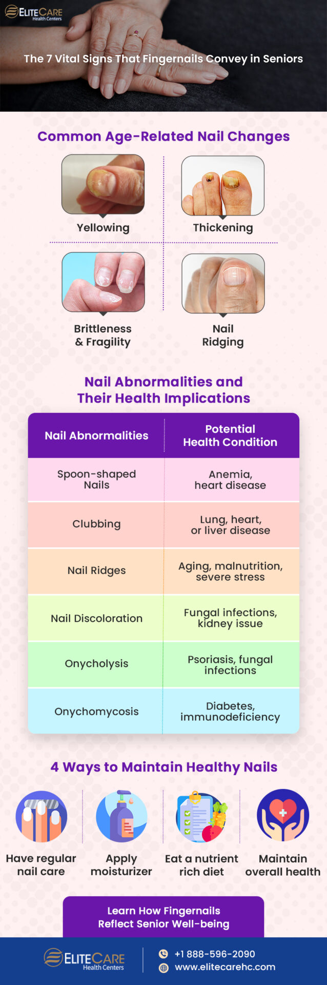 The 7 Vital Signs that Fingernails Convey in Seniors | Infographic