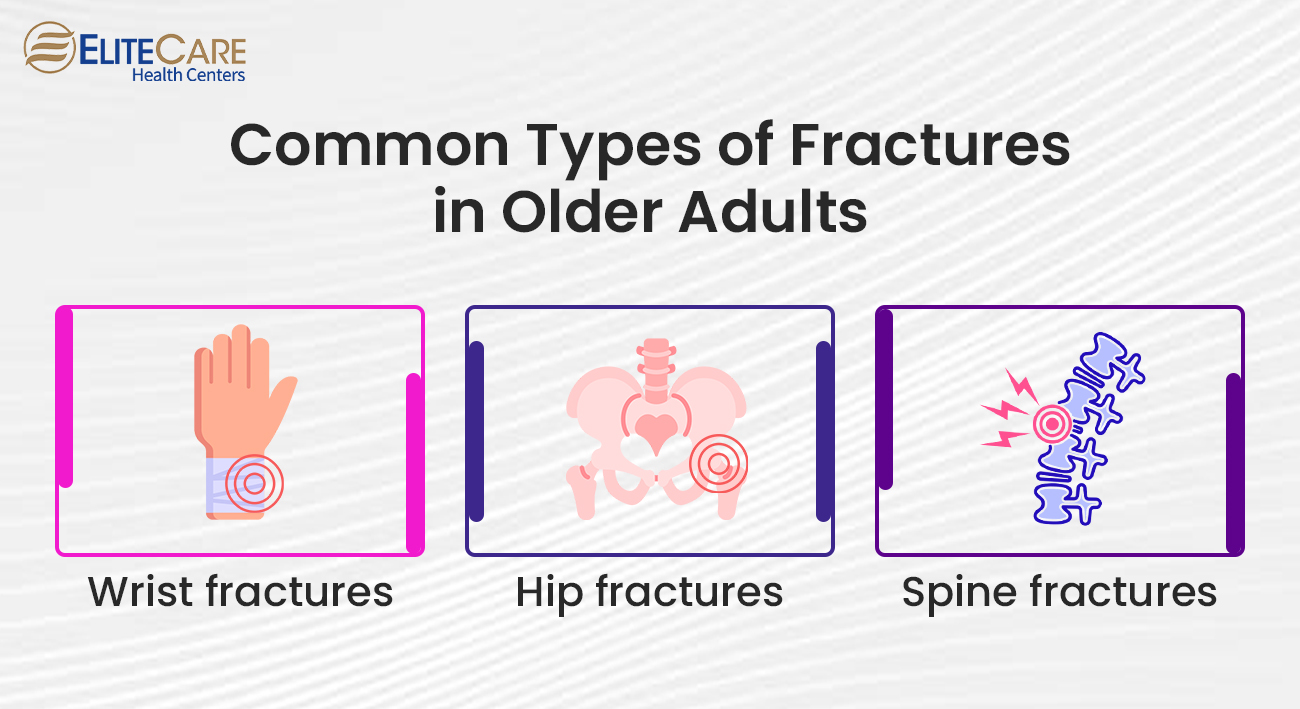 Common Types of Fractures in Older Adults