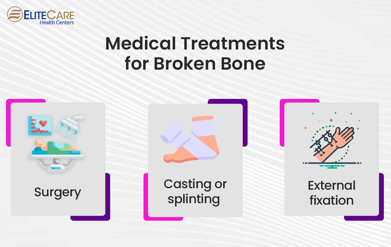 Medical Treatments for Broken Bone
