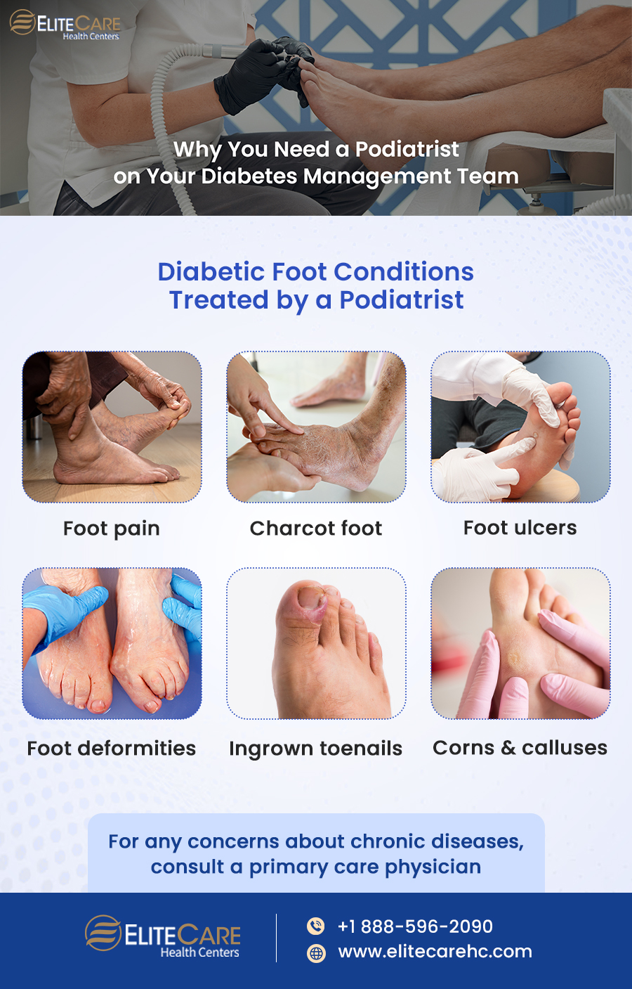 Why You Need a Podiatrist on Your Diabetes Management Team | Infographic