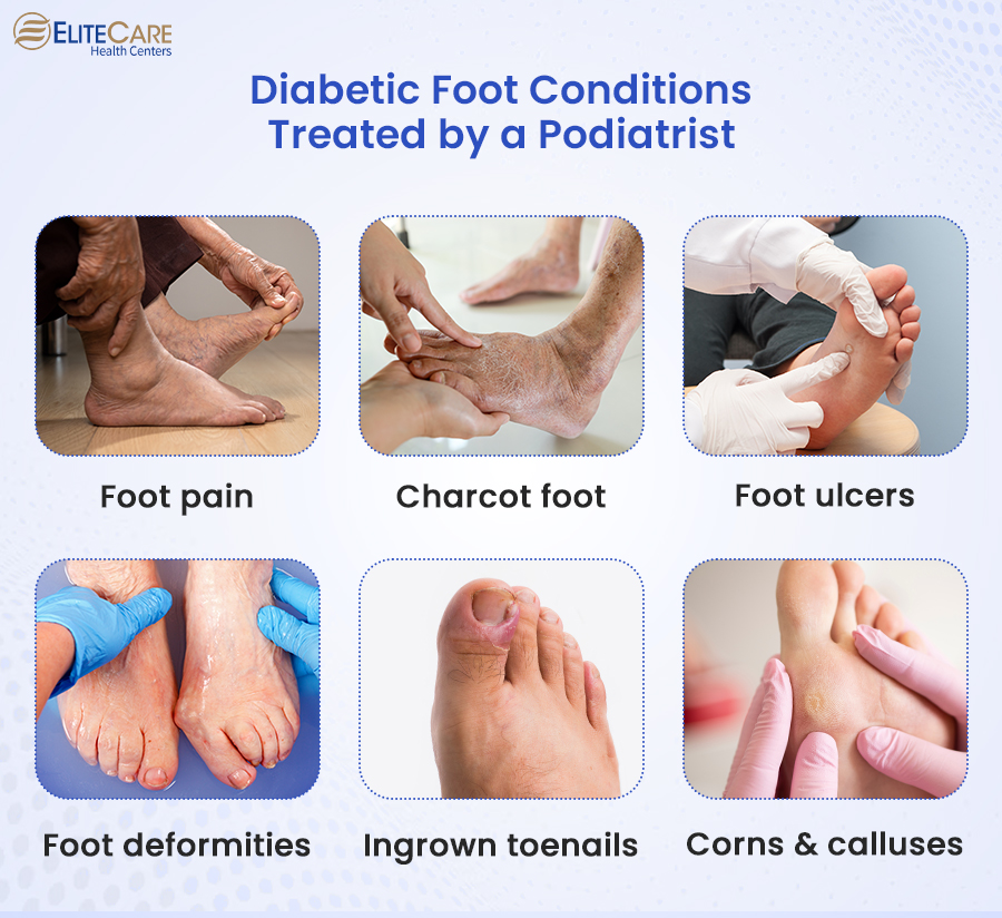 Diabetic Foot Conditions Treated by a Podiatrist