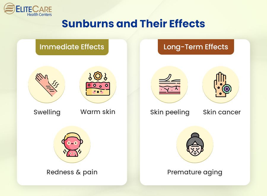 Sunburns and Their Effects