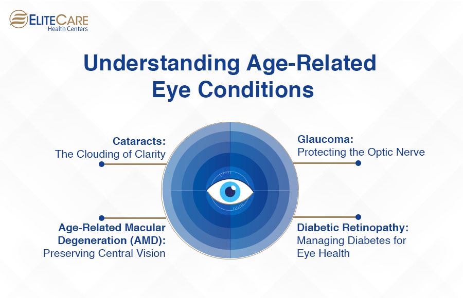 Understanding Age-Related Eye Conditions